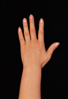 Image of Hand and forearm on a black surface