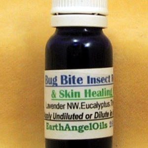 Bug Bite Skin Relief Essential Oil Blend