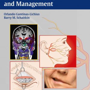 Facial Nerve Disorders and Diseases