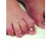 Hammertoe: A Case of Postural Distortions