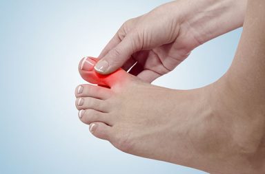 The primary cause of hammertoes is a shifting of the body so that the weight-bearing area of the foot transitions from the heel to the ball.