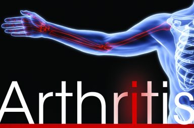 arthritis