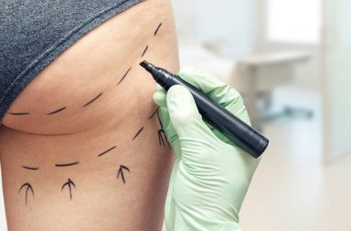 Some of our massage clients are seeking both commonly practiced cosmetic procedures and extreme cosmetic measures because they want to change or enhance their appearance.