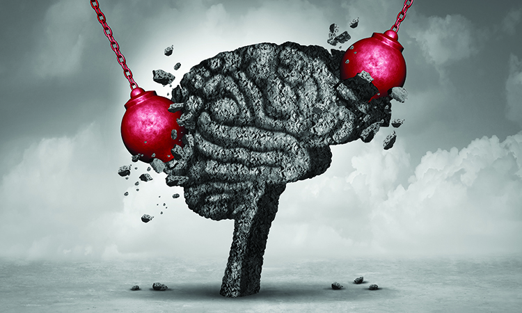 post-concussion syndrome illustration