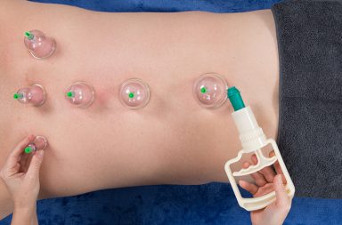 Being a massage therapist requires that we develop good communication skills to simply and easily convey key concepts about our practice to our clients and to referring medical professionals. Clients and others frequently have questions about massage cupping.