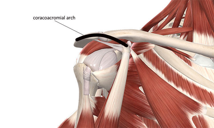 Coracoacromial arch. Image courtesy of Complete Anatomy