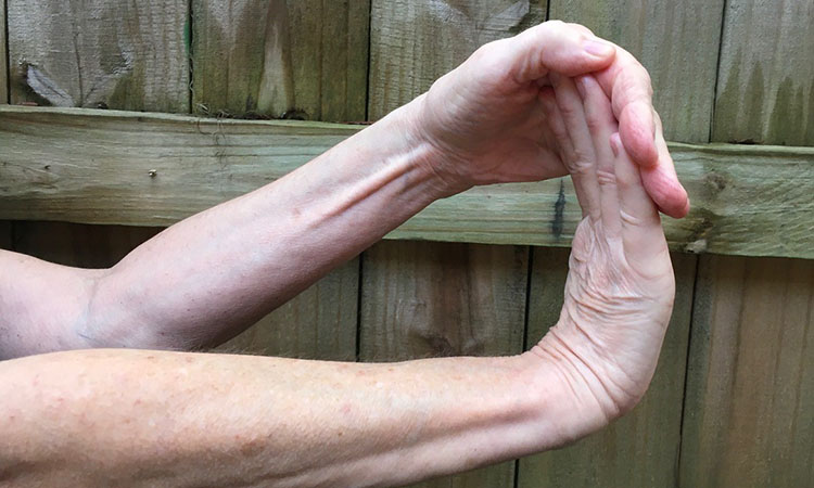 Forearm Flexors