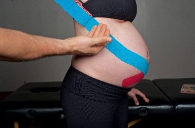 kinesiology taping techniques for pregnant women