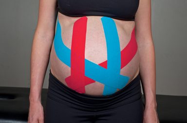 Master the art of pregnancy taping to help your pregnant clients more comp