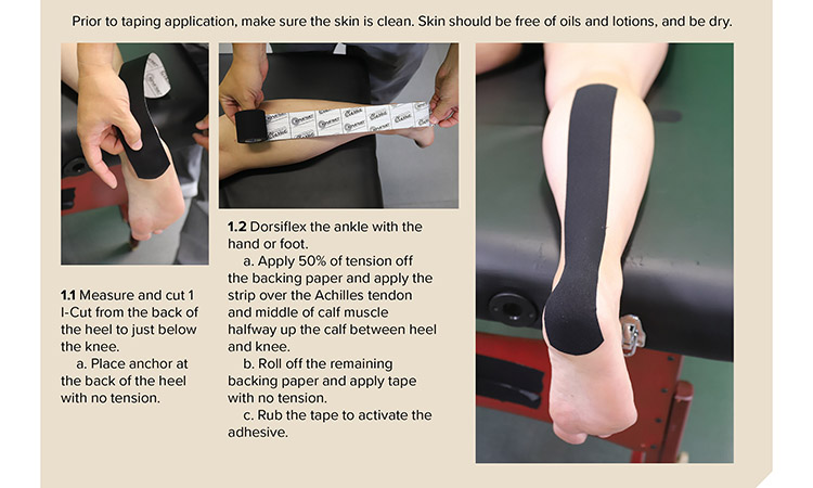 Steps for taping the Achilles tendon