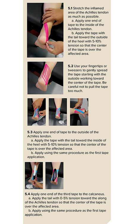 Taping the Achilles tendon