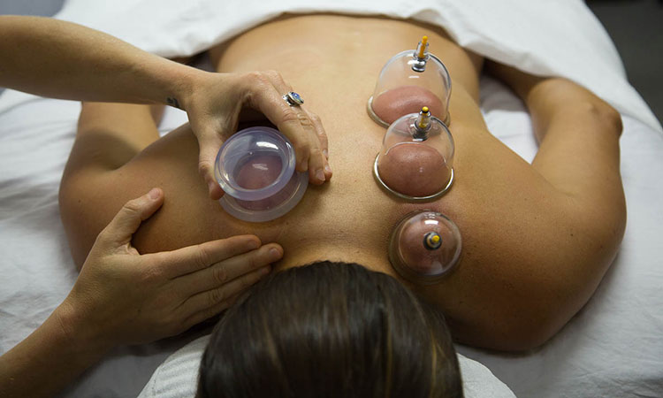 Cupping massage benefits include reduced pain, increased flexibility and decreased inflammation—and cupping massage can be used for a wide variety of clients.