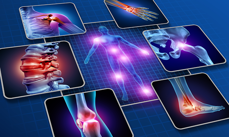 Clients with consistently widespread pain or fatigue might suffer from fibromyalgia or chronic fatigue syndrome (or both). Myofascial release can help.