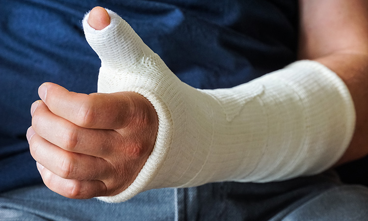 An image of a person's arm in a cast is used to illustrate the concept of a sudden injury that would require you to have a backup plan for how you would earn money.