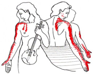 referred pain I