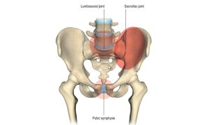 Figure 1.6: Joint pain in the pregnant pelvis. Shaded areas indicate typical range of pain. Density of shading correlates to the likelihood of pain, with the lightest being the least likely.