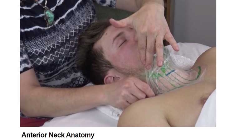 Figure 6: Author’s replica of the platysma muscle on the Anterior neck demonstrating the thin quality of the platysma muscle.