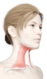 The platysma muscle